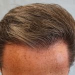 cheveux homme