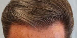 cheveux homme
